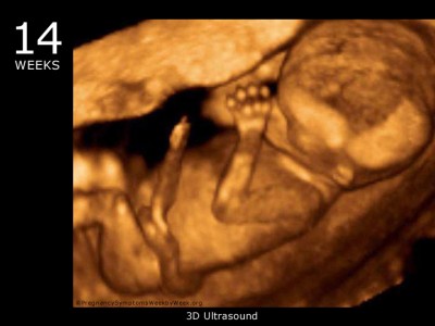 30 weeks pregnant 3d ultrasound